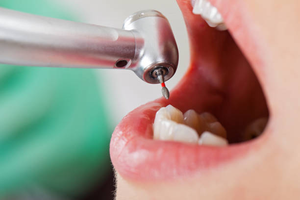 Best Emergency Treatment for Toothache in Buhl, ID
